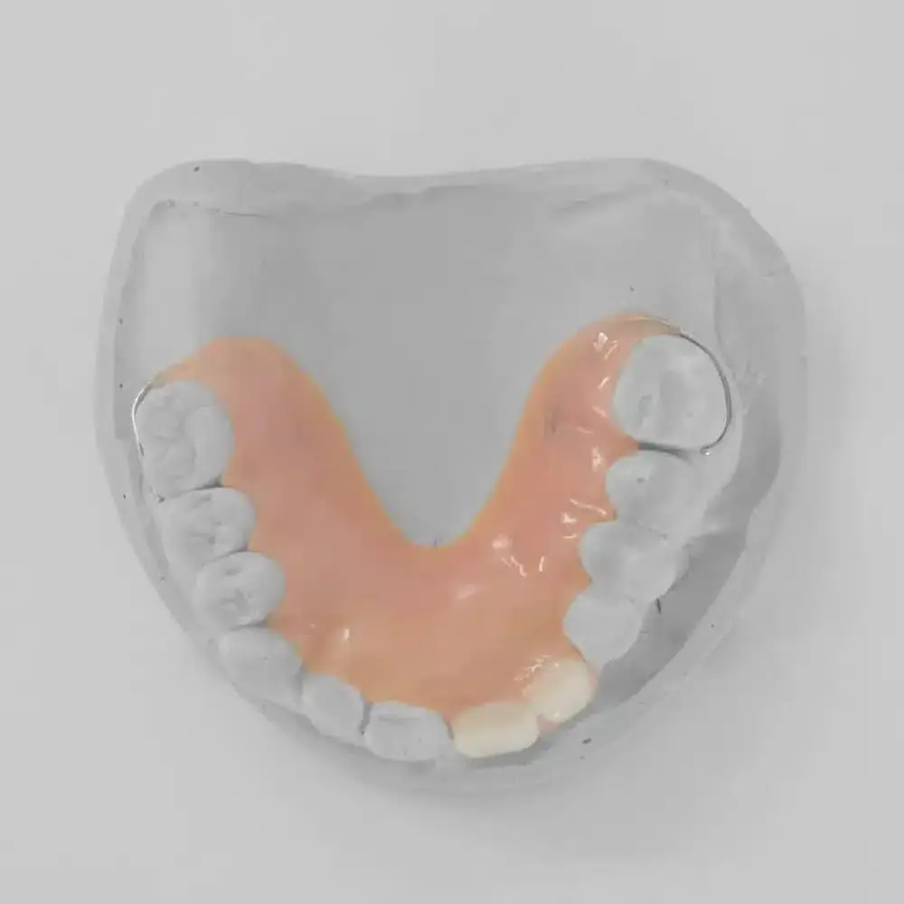 1-2 Tooth Replacement Acrylic Partial - Dentist Directed - Impression Kit Included - Image 8