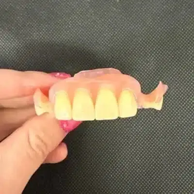 Flexible Partial Dentures - Dentist Directed - Impression Kit Included - Image 10