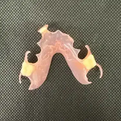 Flexible Partial Dentures - Dentist Directed - Impression Kit Included - Image 8