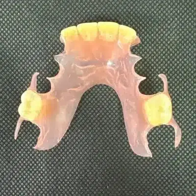 Flexible Partial Dentures - Dentist Directed - Impression Kit Included - Image 9