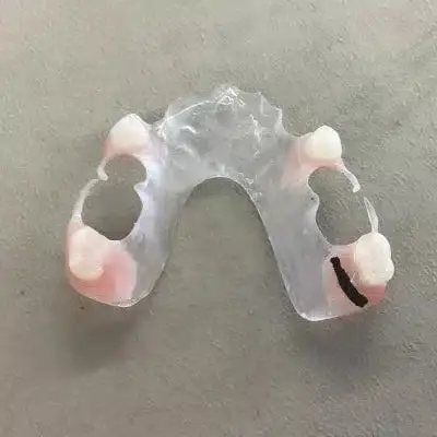 VisiClear Partial Dentures - Dentist Directed - Impression Kit Included - Image 5
