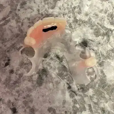 VisiClear Partial Dentures - Dentist Directed - Impression Kit Included - Image 8