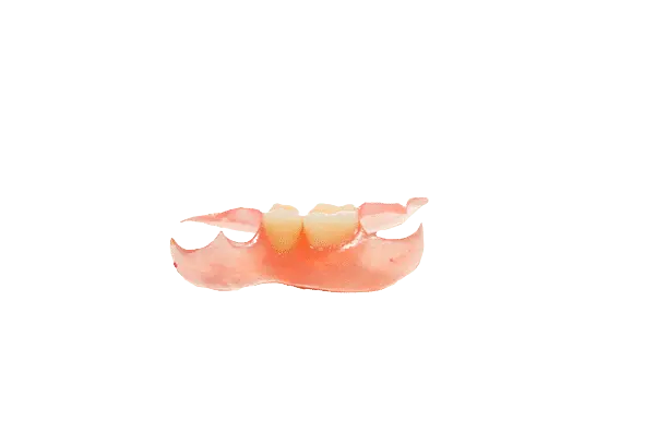 Unilateral Partial 1-3 Teeth - Dentist Directed - Impression Kit Included - Image 5