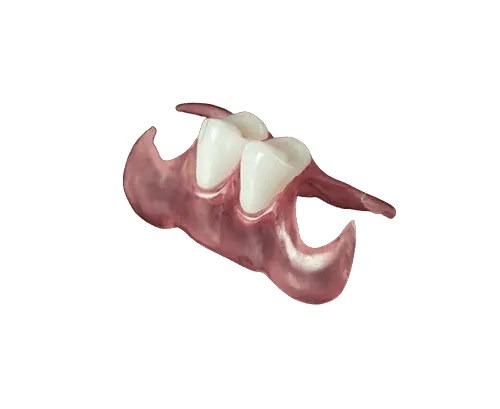 Unilateral Partial 1-3 Teeth - Dentist Directed - Impression Kit Included - Image 9